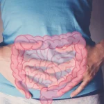 Cual es la causa de que la enfermedad intestinal inflamatoria sea difícil de tratar