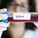 RD: Personas que viven con VIH en el país serán las más afectadas por la suspensión de fondos a USAID