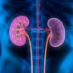 Cómo Prevenir la Enfermedad Renal Crónica