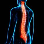 Consorcio Europeo Utiliza IA para Tratar la Degeneración Vertebral