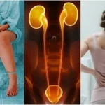 ¿Cómo saber si tus riñones no funcionan bien? 10 síntomas clave