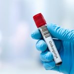 «Alerta en Nueva York por primer caso de chikungunya transmitido localmente desde 2019»