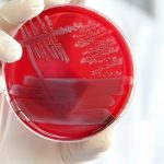 Descubrimiento Científico: Un Mecanismo Clave para Desactivar la Inflamación y sus Implicaciones para la Salud