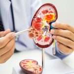 «Alerta médica: Estos dos alimentos dañan tus riñones y no lo sabías»