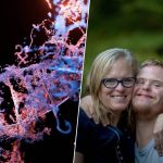 Silenciar el cromosoma del síndrome de Down: ¿Un paso hacia la medicina del futuro o un peligro ético?