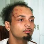 «Agentes del ICE golpean y abandonan a joven dominicano en Nueva York tras detención por error»