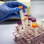 «CIBIR desarrolla terapia génica para prevenir el alzhéimer: Un paso hacia la cura»
